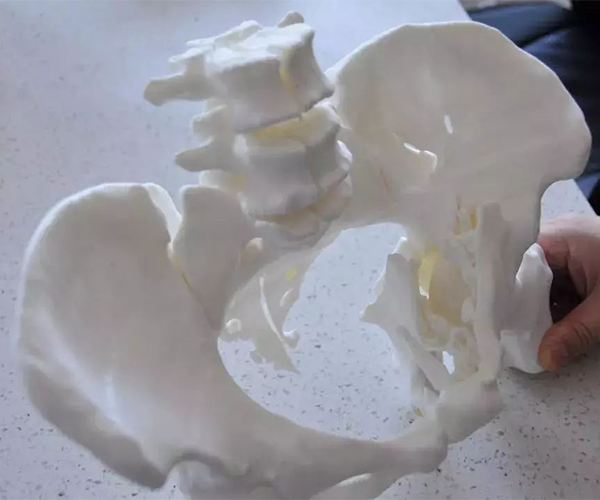 医疗模拟模型打印医疗器具打印制作