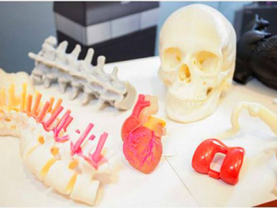3D打印完成的医疗模型