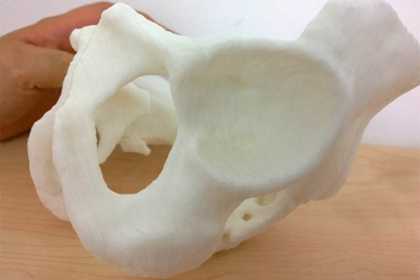 3D打印技术制作的骨头模具