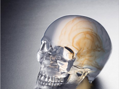 3D打印的医疗模拟用具